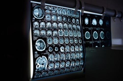 Why Neurologists Should Partner With A Management Services Organization