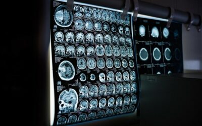 Why Neurologists Should Partner With A Management Services Organization